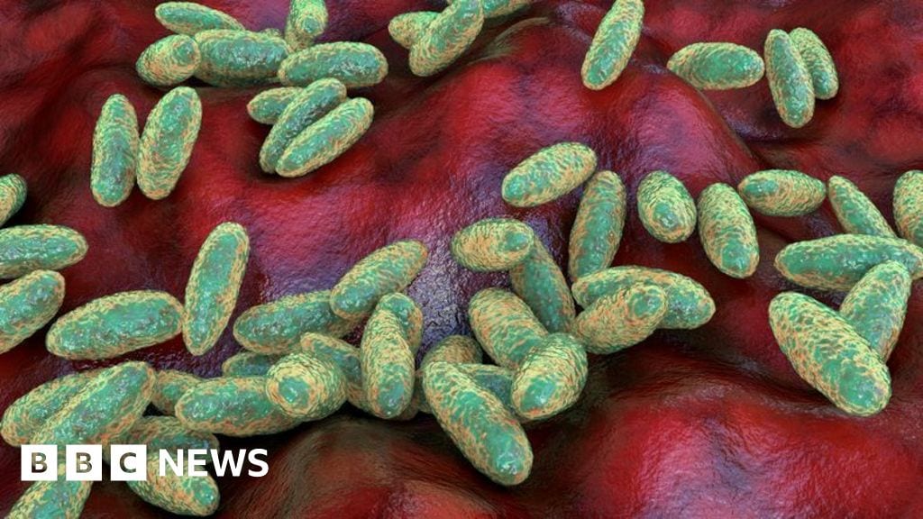 Tod im Pestlabor: Wir brauchen die Fakten